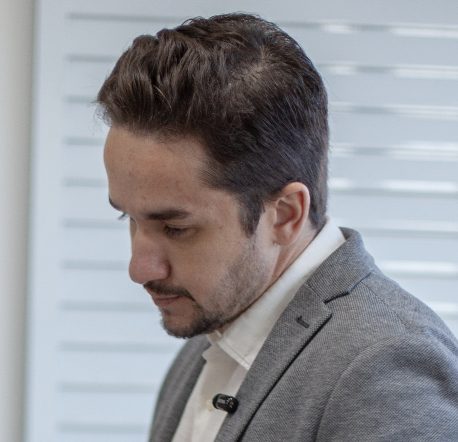 Dr. Tales Vieira — Transplante Capilar FUE em Indaiatuba